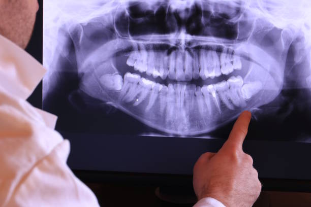 Best Emergency Treatment for Jaw Pain or Injury in Hartington, NE