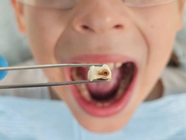 Best Emergency Dental Care for Sports Injuries in Hartington, NE